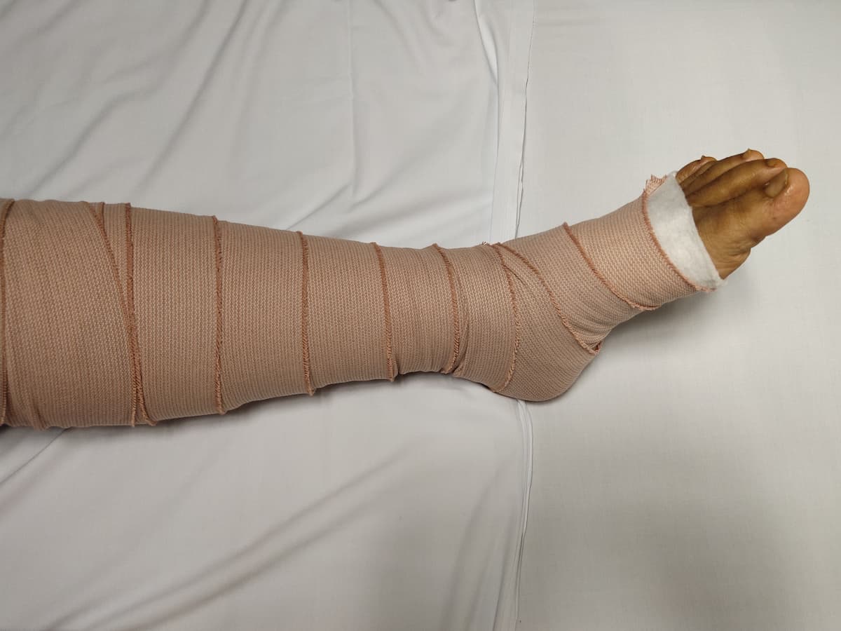 Compression Therapy Benefits | Vein Doctor of NJ