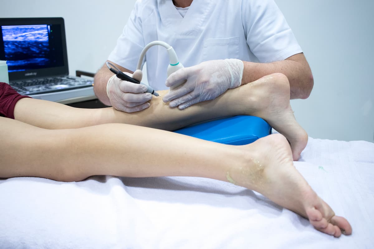 Endovenous Laser Treatment (EVLT) - EVLT in Hazlet | Vein Doctor of NJ